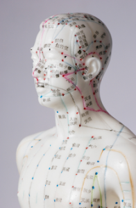 acupuncture chinoise douleur